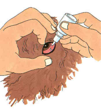 Einbringen von Augentropfen