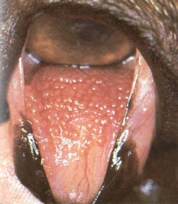 Follikukäre Bindehautentzündung